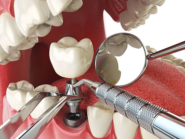 Best Emergency Dental Care for Abscessed Tooth in Mansfield, AR